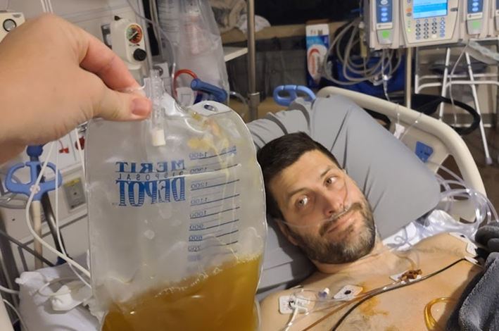 Platelet bag resembling turkey gravy