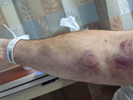 Illustration of being poked and prodded during hospital stay